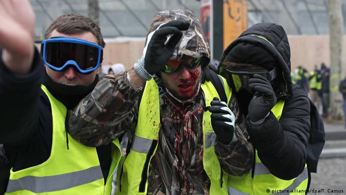 Протестующие во время акции желтых жилетов, один из них ранен